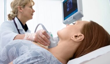 Defining the limits of immunotherapy in early small-cell lung cancer