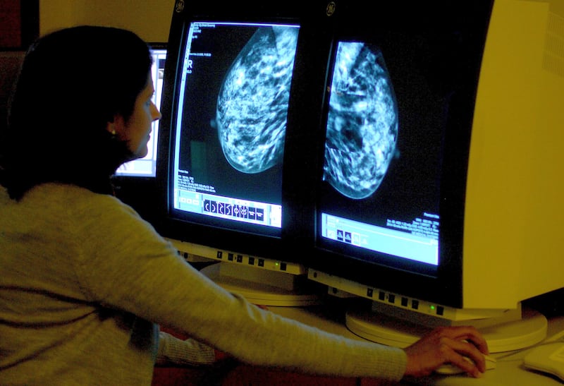 Mammograms can detect breast cancer early, often before a lump can be felt