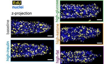 A team of researchers at Princeton, capturing in detail the metabolic effects of high-fat nutrients, found that a high-fat diet accelerates growth and invasion of breast cancer tumors. Credit: Kohram et al.