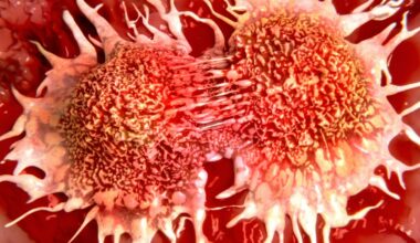 New Experimental Drug Shrinks Tumors in Prostate Cancer Clinical Trial : ScienceAlert