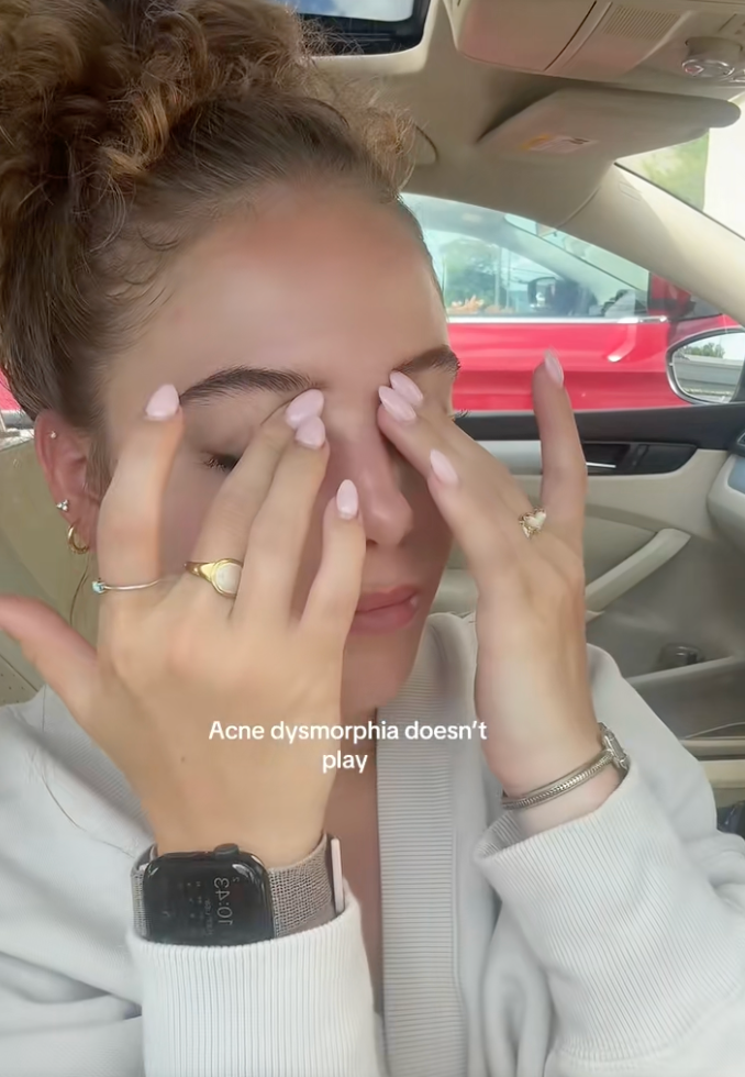 Maddie Ogle has shared her experience with skin dysmorphia on TikTok