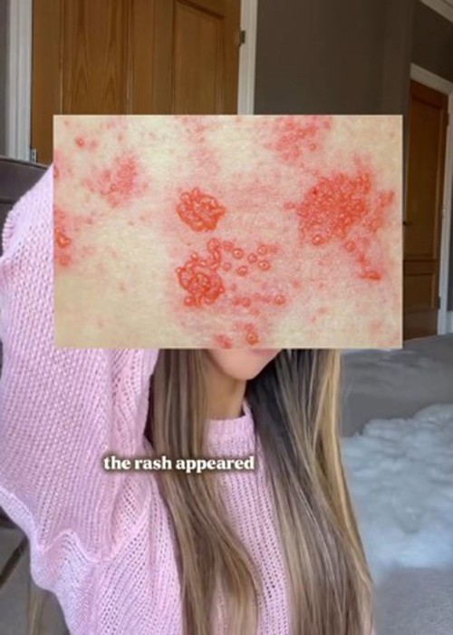 Pic: Emily Andre/Instagram