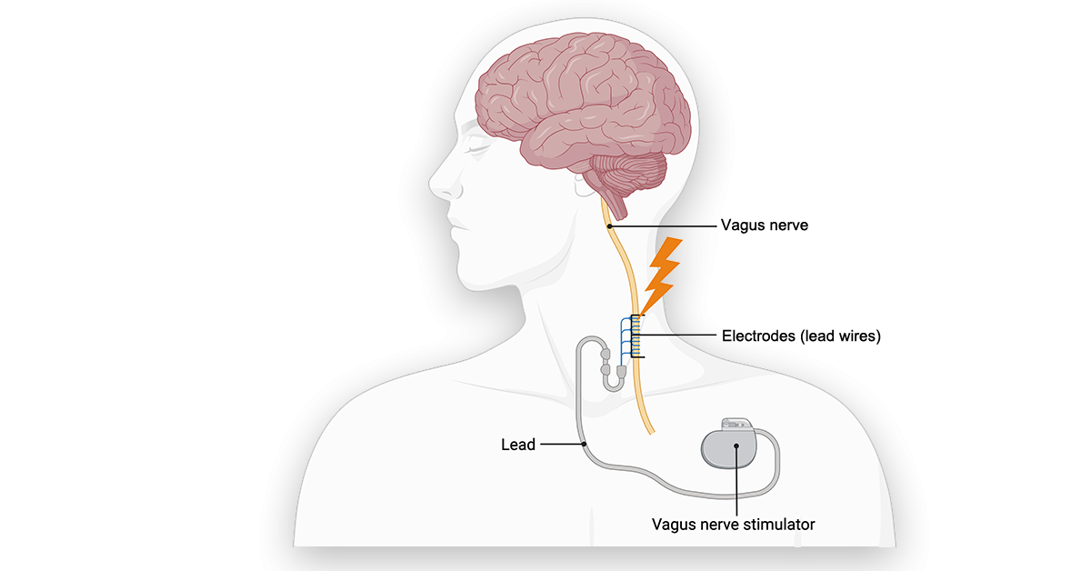 Review Maps Today’s Science, Points to Tomorrow’s Therapies