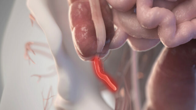appendix