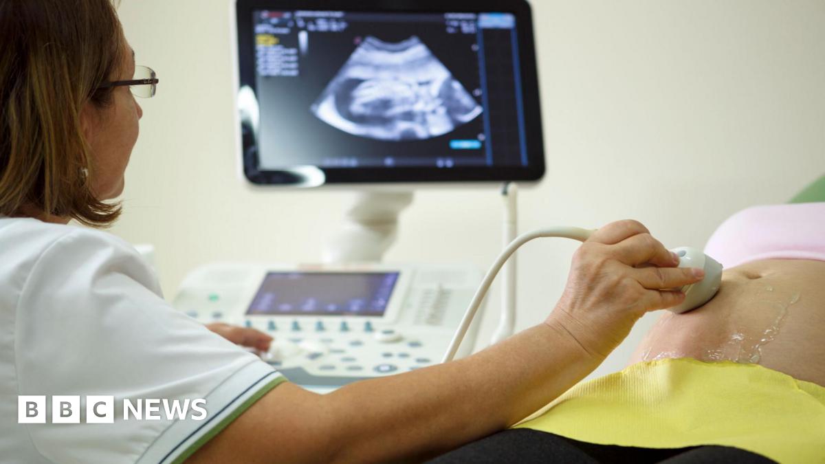 A sonographer carries out an ultrasound scan of a pregnant woman who is lying flat and exposing her abdomen. The probe is placed on the skin which is covered with gel and a screen shows images of the foetus in the background.