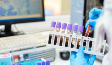 Blood Lactate Is a Key Biomarker for ALS Prognosis