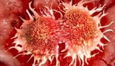 Evolving cancer trends present challenges for life and health insurers