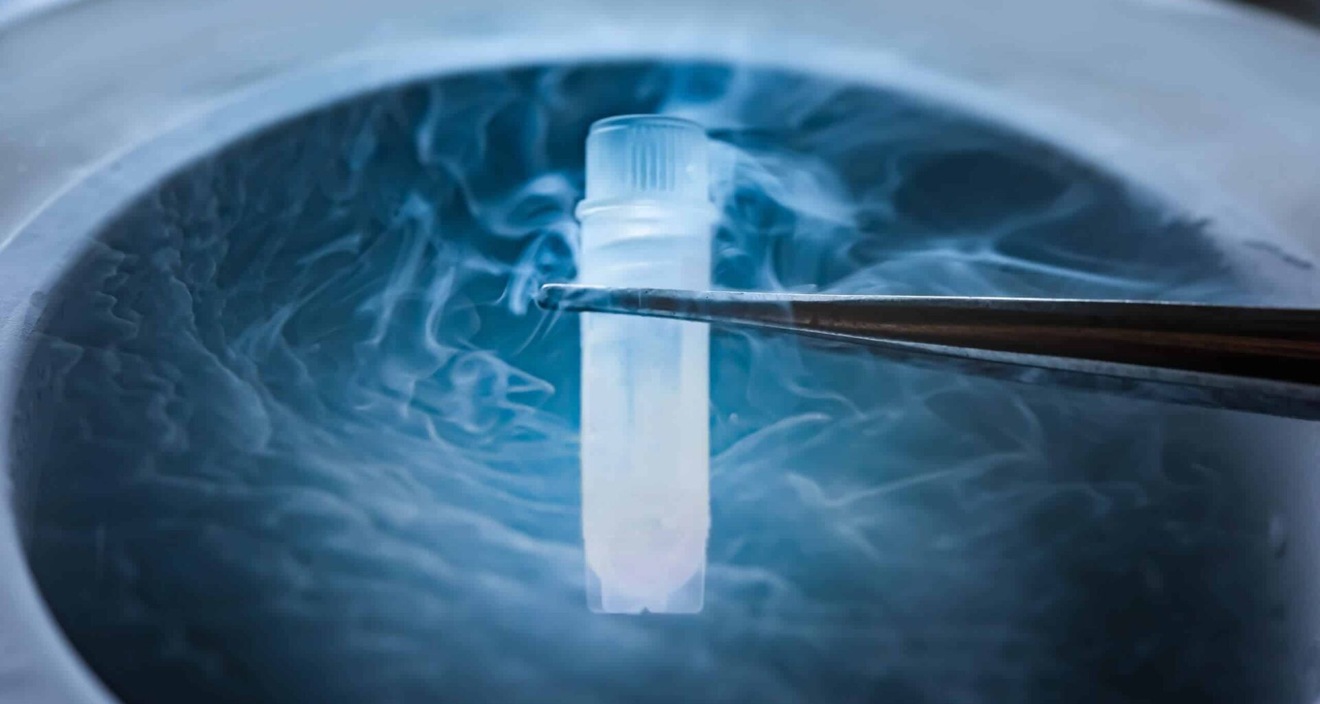 Mouse Brain Tissues Recover Key Activity After Deep Freeze, but Cryonics Remains Far Off