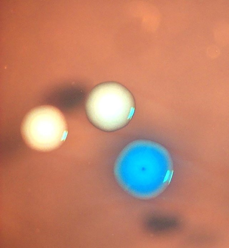 Colonies of cells resulting from Whole Genome Transplantation (WGT) that resemble floating coloured dots.