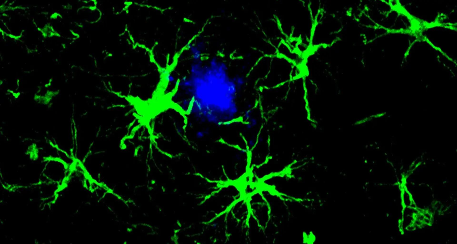 Scientists turn brain cells into Alzheimer’s plaque cleaners