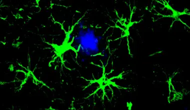 Scientists turn brain cells into Alzheimer’s plaque cleaners