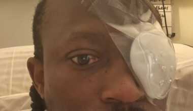 Gardaí investigating after Limerick hip hop artist partially blinded in baseball bat assault - The Journal