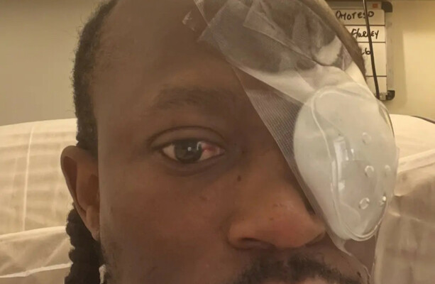 Gardaí investigating after Limerick hip hop artist partially blinded in baseball bat assault - The Journal