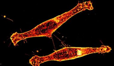 New method slows Huntington's disease by targeting neuron paths