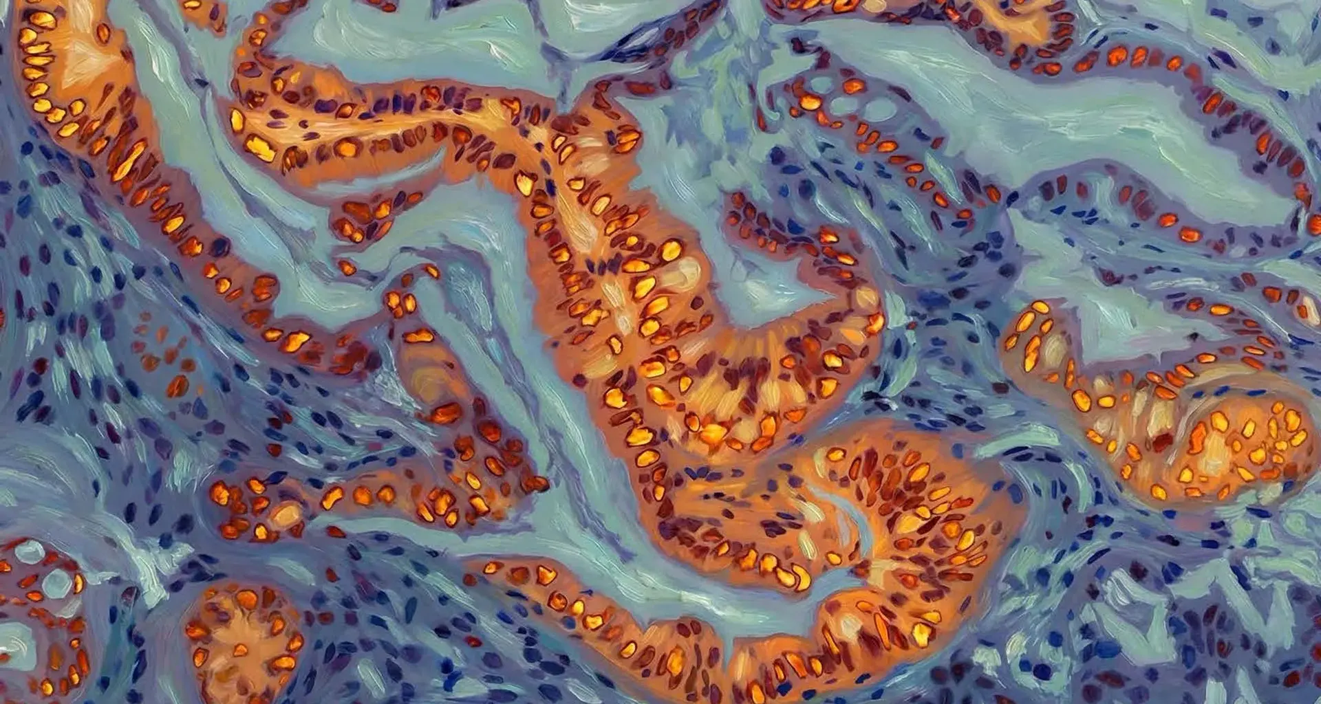 Scientists find the genetic switch that makes pancreatic cancer resist chemotherapy