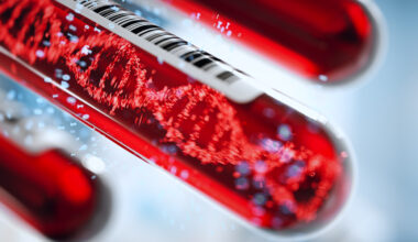 AI-Backed Liquid Biopsies Identify Liver Diseases