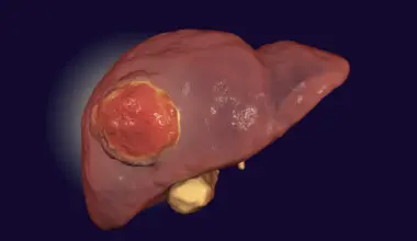 Eating less protein may slow liver cancer growth, study finds