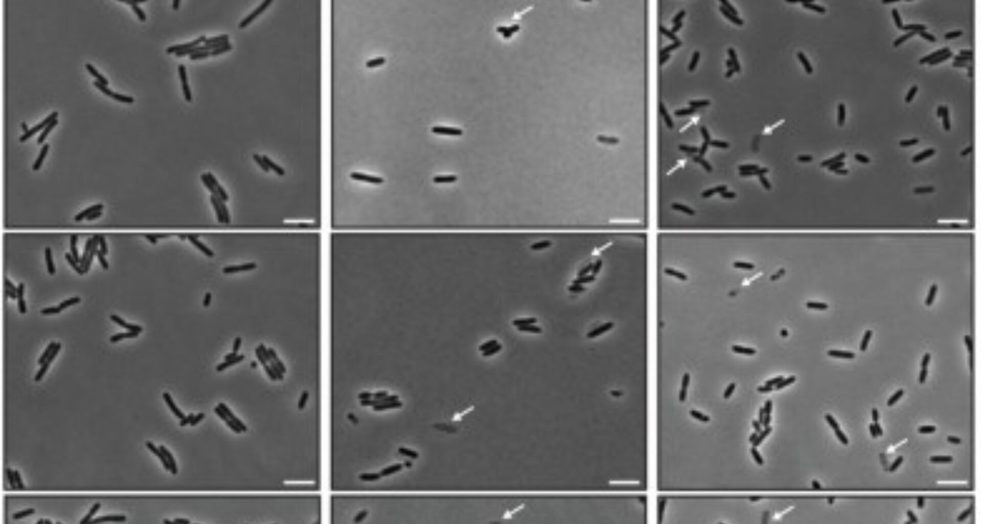 Viral strategy exposes promising antibiotic target