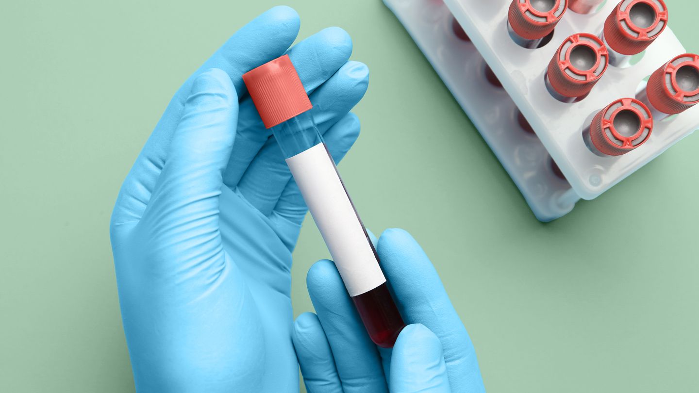 Blood Test May Predict Dementia in Women 25 Years Before Symptoms Appear