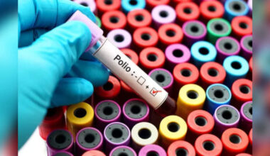 Pakistan Reports First Polio Case of 2026, Urges Swift Action, ETHealthworld