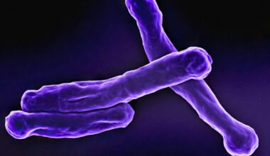 Israel reports pulmonary TB patient at Sheba Medical Center