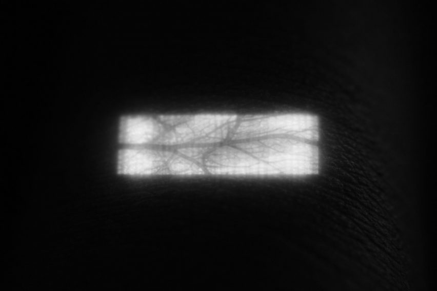 Image of a narrow rectangle of light with a pattern of dark veins branching through it