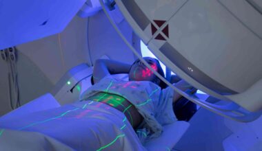 Scientists uncover how radiation can unintentionally benefit tumors