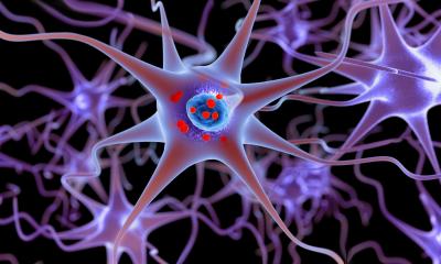 New biomarker improves diagnosis of Parkinson's and LBD • healthcare-in-europe.com