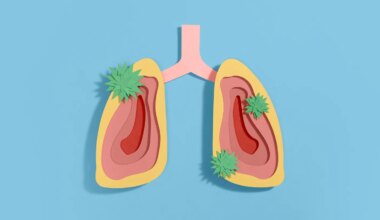 Severe Flu or COVID-19 Could Raise Lung Cancer Risk