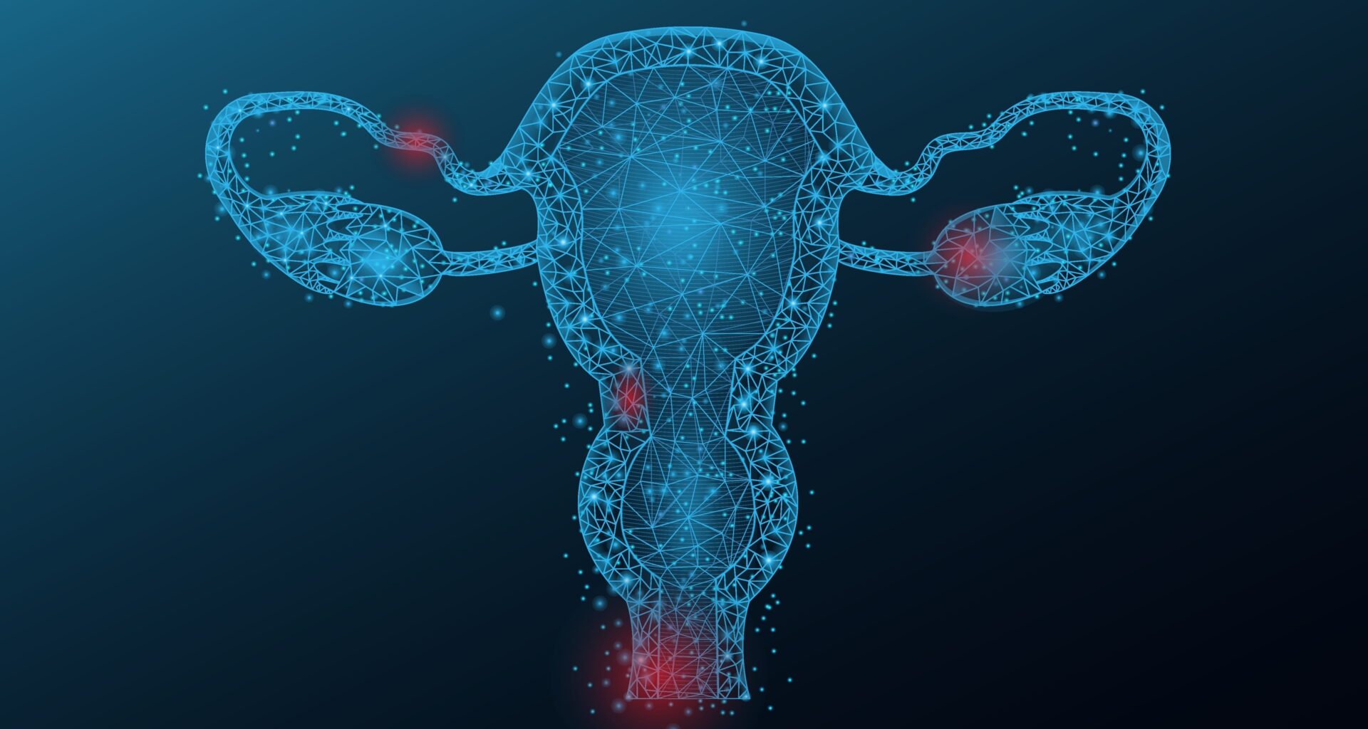 Blocking FAK protein may help to overcome resistance in ovarian cancer