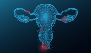 Blocking FAK protein may help to overcome resistance in ovarian cancer