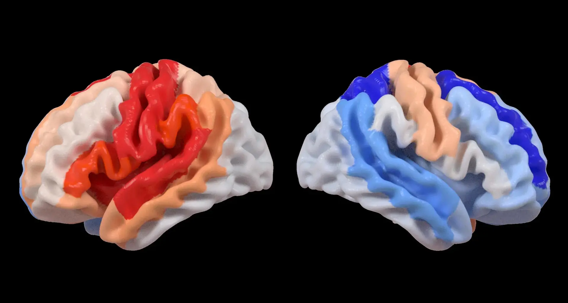 Stroke triggers a hidden brain change that looks like rejuvenation