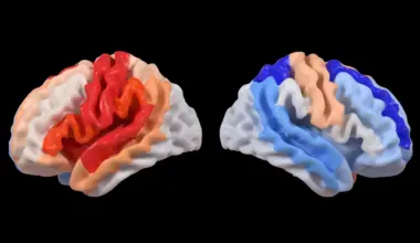 Stroke triggers a hidden brain change that looks like rejuvenation
