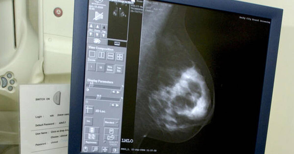 Tipperary nurse sues over alleged delay in breast cancer diagnosis