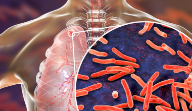 WHO Europe and ECDC publish new joint surveillance report