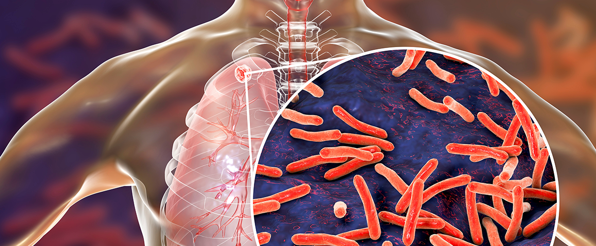 WHO Europe and ECDC publish new joint surveillance report