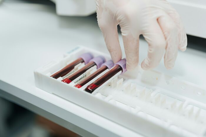 Gloved hand handling blood samples in tubes on a tray, revealing behind-the-scenes feelings and opinions of doctors