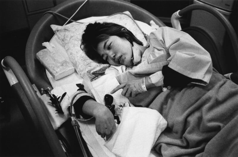 A person lies in a hospital bed, resting their head on a pillow, covered with a blanket, with a hospital wristband on their arm. They appear to be recovering, with medical equipment visible nearby.