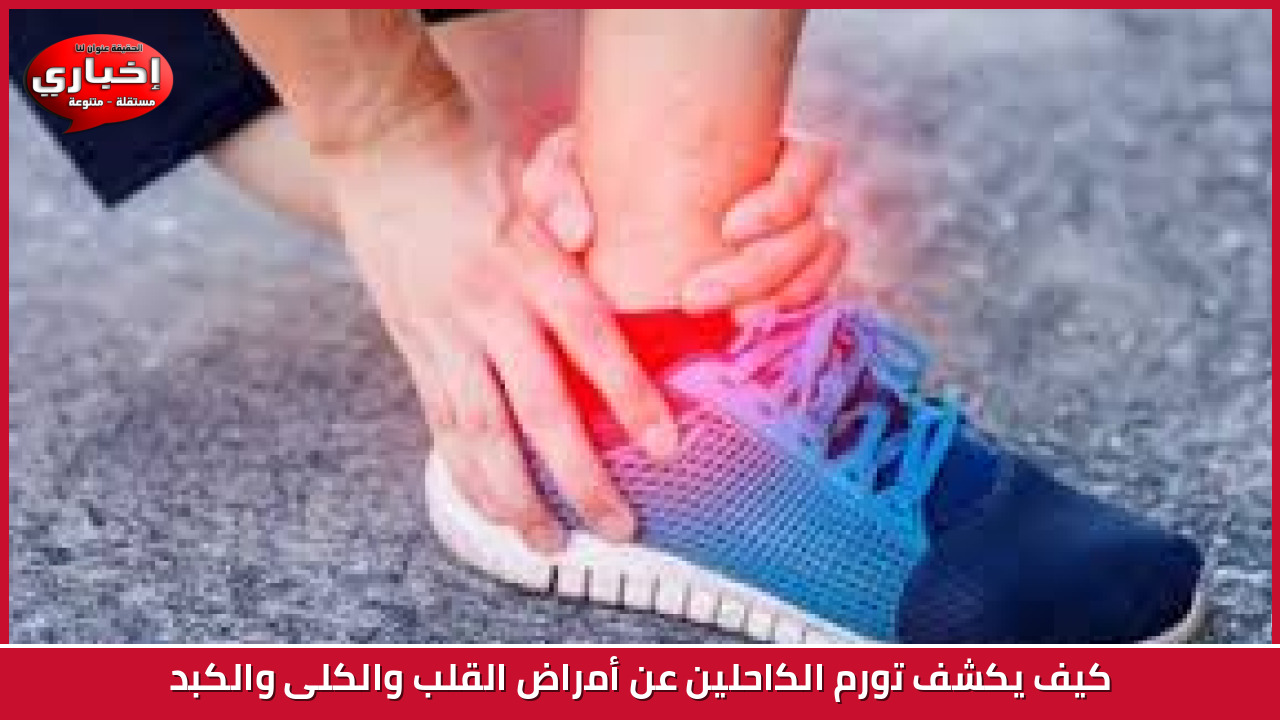 Key Inflation Gauge Rises in January, Dampening Hopes for Early Interest Rate Cuts