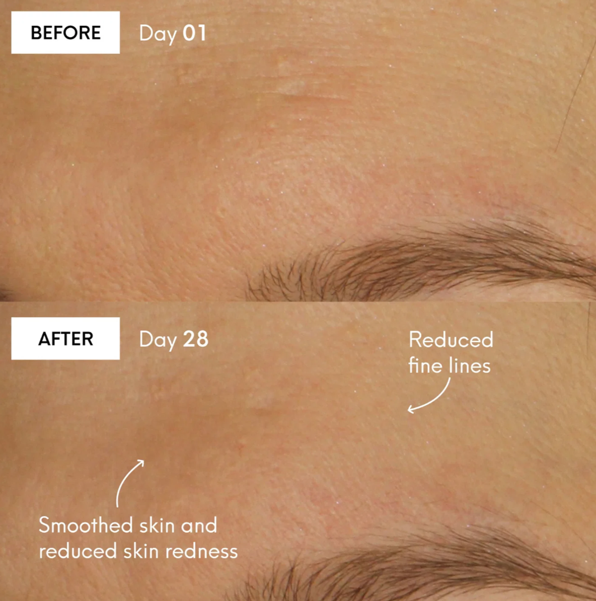 Results can be seen here using Avant's skincare