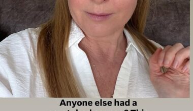 Emmerdale star Michelle Hardwick has revealed she was rushed to hospital with a painful and swollen eye as she shared a photo of the injury