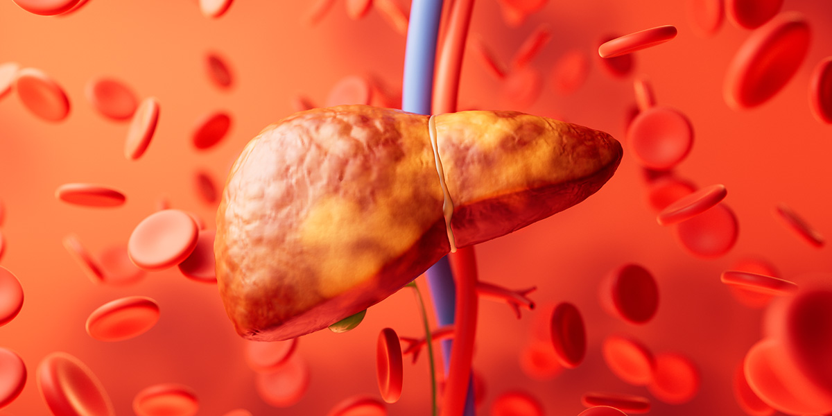 Cholesterol regulatory genes predict liver transplant outcomes