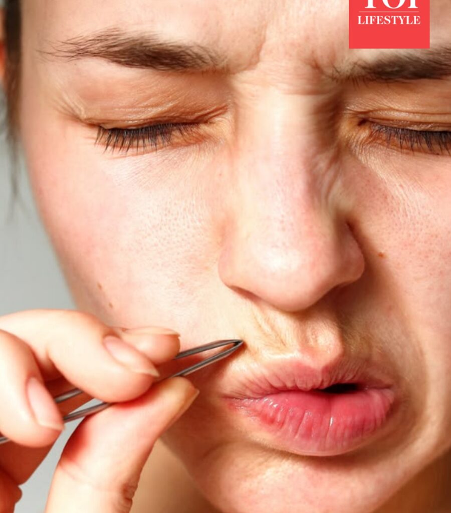 7 easy natural remedies to remove facial hair at home for women with PCOS