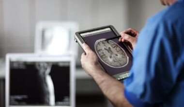 Low birth weight can increase risk of stroke in young adulthood, study shows