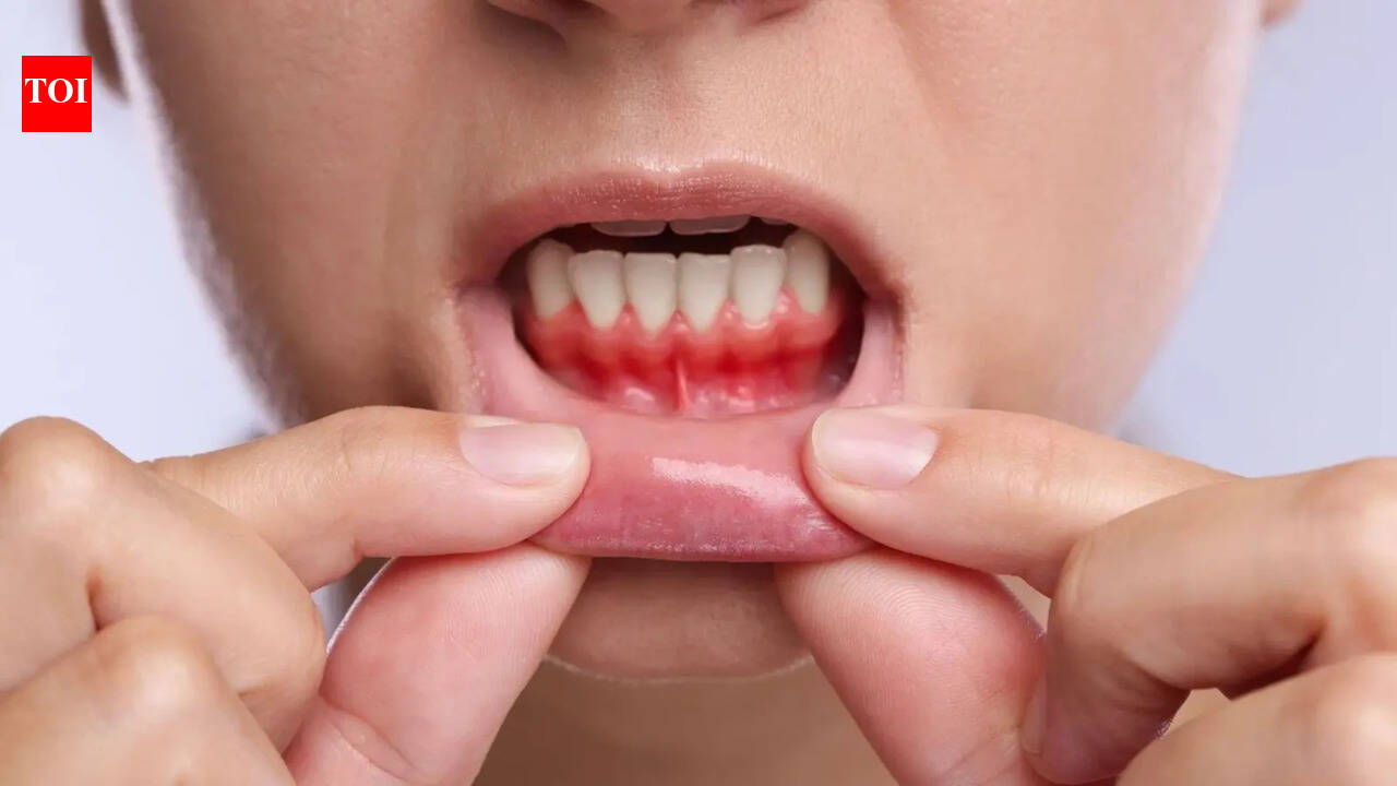 Gum Health: Bleeding gums may signal more than oral disease: How gum health is linked to heart risk and inflammation |
