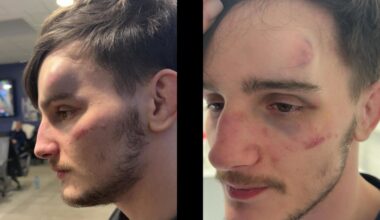 Mum says son ‘still in shock’ after gang attack at GAA club – The Irish News