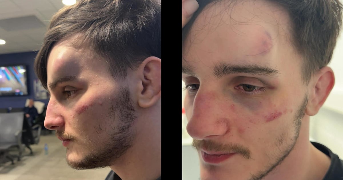 Mum says son ‘still in shock’ after gang attack at GAA club – The Irish News