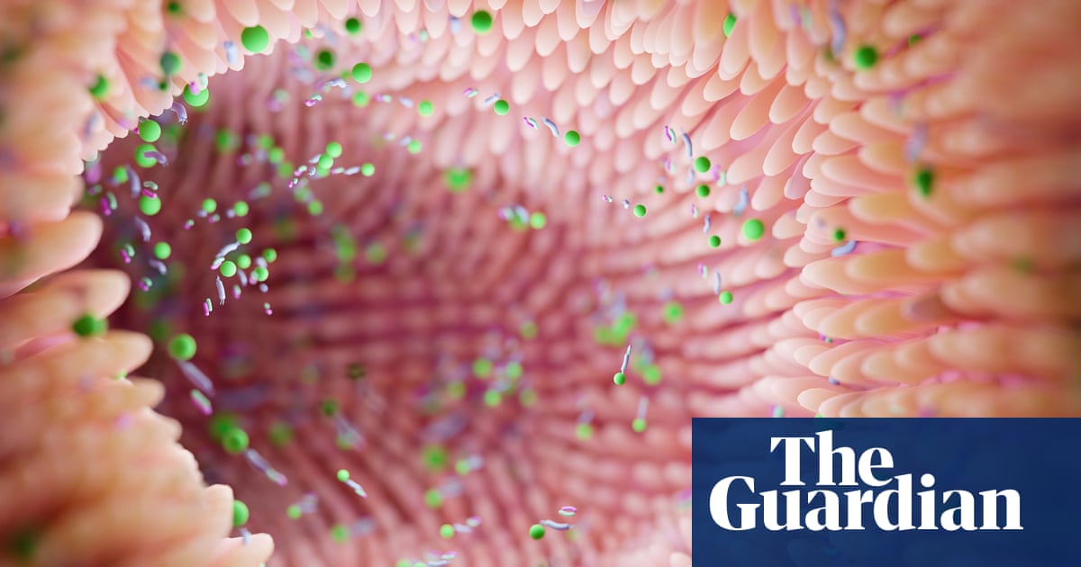 Gut microbiome can reveal risk of Parkinson’s, scientists say | Parkinson's disease