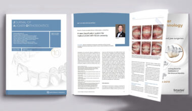 New Classification System of Malocclusions Published in the Journal of Aligner Orthodontics (JAO) by Prof. Gang Shen's Team