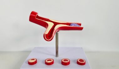 Thromboxane A₂ receptor structure mapped for blood clotting drug development